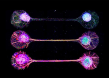 Scientists create 'minibrains' using cells from multiple donors