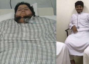 World's heaviest man alive loses 1,195 pounds in historic transformation