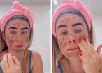 WHAT? Brazilian influencer uses her feces as a face mask