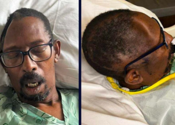 Atlanta couple sues hospital for misplacing part of patient’s skull after brain surgery