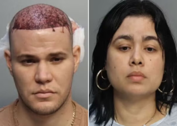 American Airlines passenger removed from plane after hair transplant begins to bleed