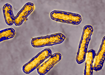 Listeria outbreak in the US: Symptoms, prevention and all you need to know