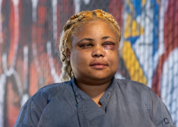 San Francisco: Netflix celebrity chef Wendy Drew Injured in brutal, racially charged assault