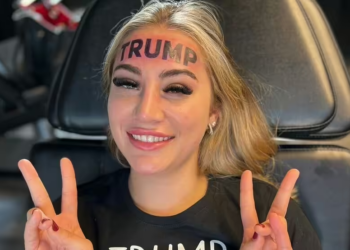 Woman who got Trump tattoo on forehead is now seeking financial help to have it removed
