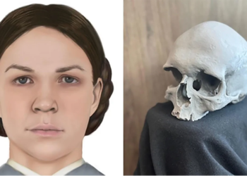 Chicago: Skull found during home renovations in 1978 identified as 19th-century woman