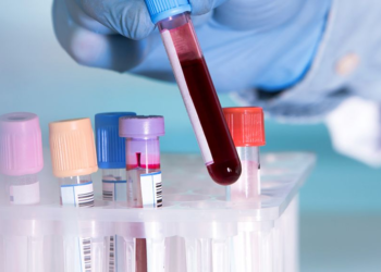 Blood Test