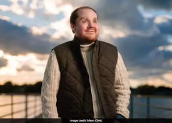 Michigan man receives successful rare face transplant after suicide attempt