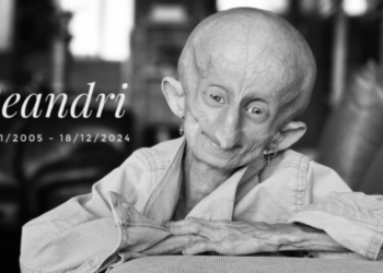 What is Progeria? TikTok star Beandri Booysen, who documented her battle with the rare rapid aging disease, dies at 19