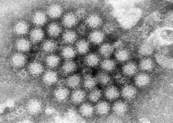 Norovirus cases double in the US: What you need to know