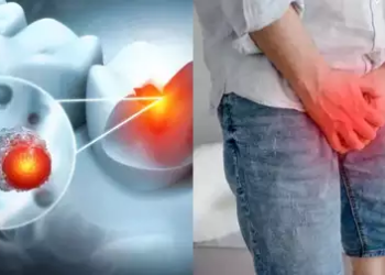 Man goes to doctor for toothache, leaves with a shocking prostate cancer diagnosis