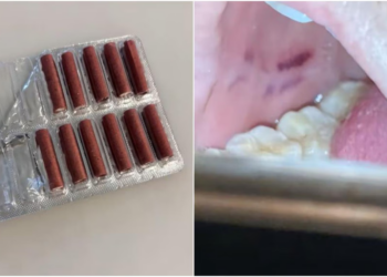Chinese woman mistakenly eats firecracker thinking it was candy, suffers injuries