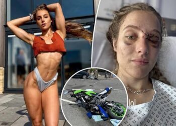 Neuroscientist-turned-OnlyFans model suffers memory loss after freak motorcycle crash with Pigeon