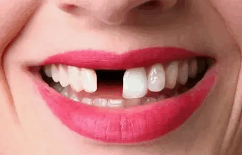 Scientists test drug that could regrow human teeth, may replace implants