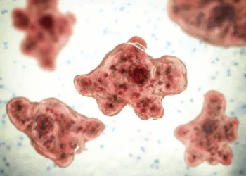 Texas woman dies from brain-eating amoeba after nasal rinse: What is Naegleria fowleri and how to avoid it?