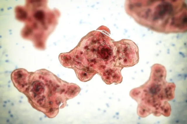 What is Naegleria fowleri and how to avoid it?