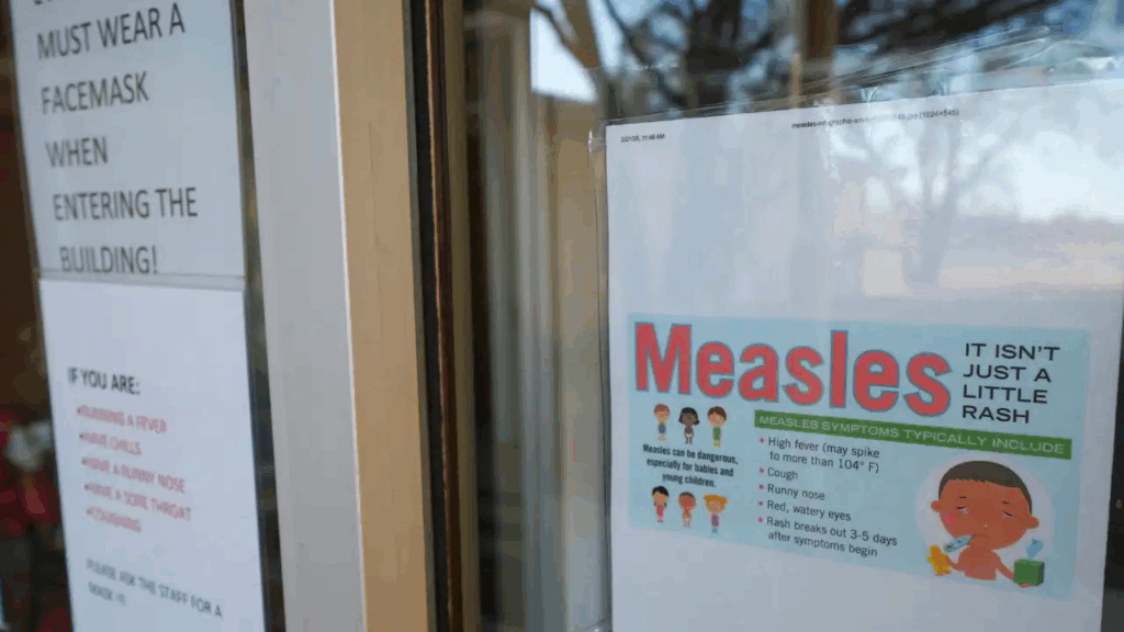 US Measles Outbreak Reaches 33-Year High With Over 1,288 Cases in 2025