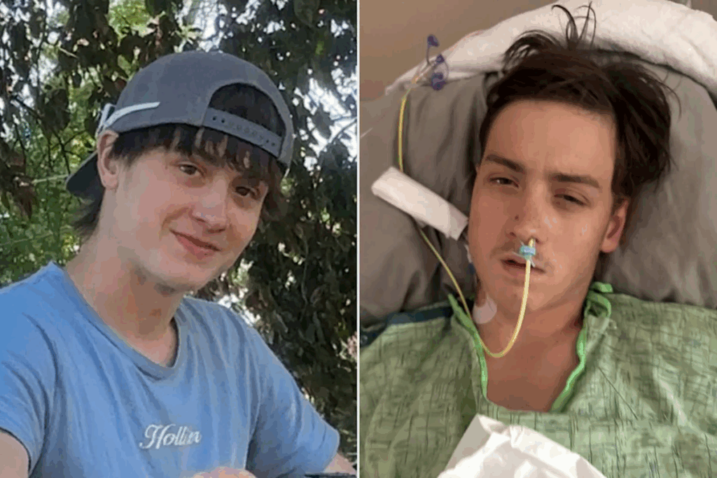 Iowa Teen Suffers Kidney Failure and Temporary Loss of Speech After Spider Bite