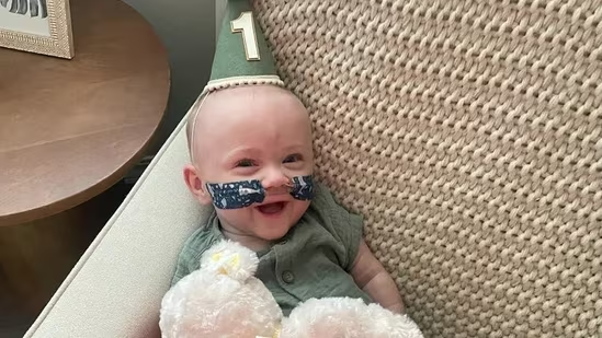 Who is Nash Keen? World’s Most Premature Baby Celebrates First Birthday