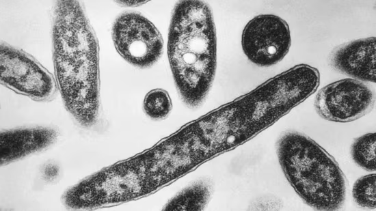 Legionnaire's Disease Outbreak in Harlem, NYC: What It Is, Symptoms, and Safety Tips
