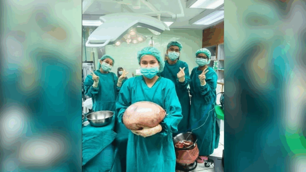 Thai Woman, Mistaken for Overweight, Undergoes Life-Saving Surgery to Remove 8 kg Ovarian Tumor