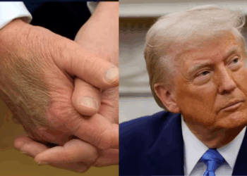 New Bruise on Trump’s Hand Rekindles Health Concerns Despite White House Assurances