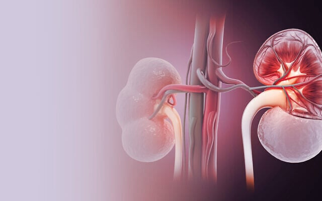 Israeli Hospital Grows Lab-Made Kidneys, Eyes Clinical Trials