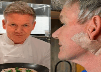 Gordon Ramsay Reveals Skin Cancer Treatment, Urges Fans to Wear Sunscreen