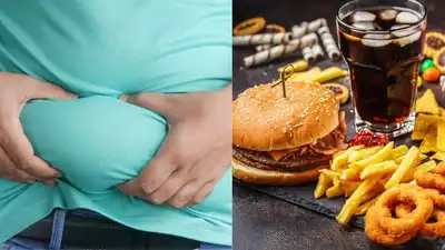 UNICEF: Childhood obese now more common than underweight worldwide