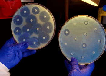 What is Nightmare Bacteria? Drug-Resistant Superbugs Rapidly Rising in the US