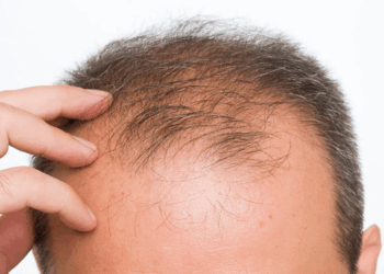 Popular Hair Loss Drug Finasteride Linked To Suicide Risk, New Study Warns