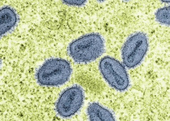 California reports first U.S. case of severe mpox strain with no travel link