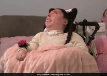 Nebraska Woman Born Without Brain, Given Only Four Years To Live, Celebrates 20th Birthday