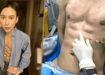 Influencer Spends $560,000 on Acid Injections to Create Artificial 8-Pack Abs