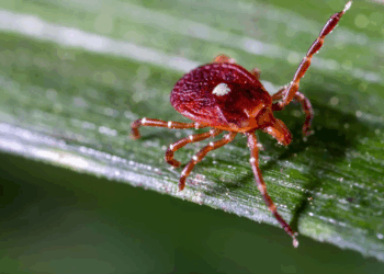 Man Dies After Eating Burger Due To Alpha-Gal Syndrome: Understanding The Rare Tick-Borne Meat Allergy