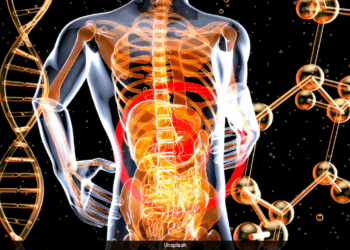 Surge In Diverticulitis Among Younger Americans Challenges ‘Older Adults’ Disease’ Label