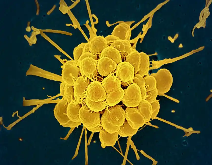 New FDA-Approved Antibiotics Offer Hope Against Drug-Resistant Gonorrhea