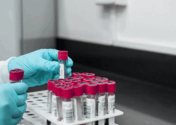 Are Scientists Finally Closing In On An HIV Cure? What a New UCSF Study Reveals