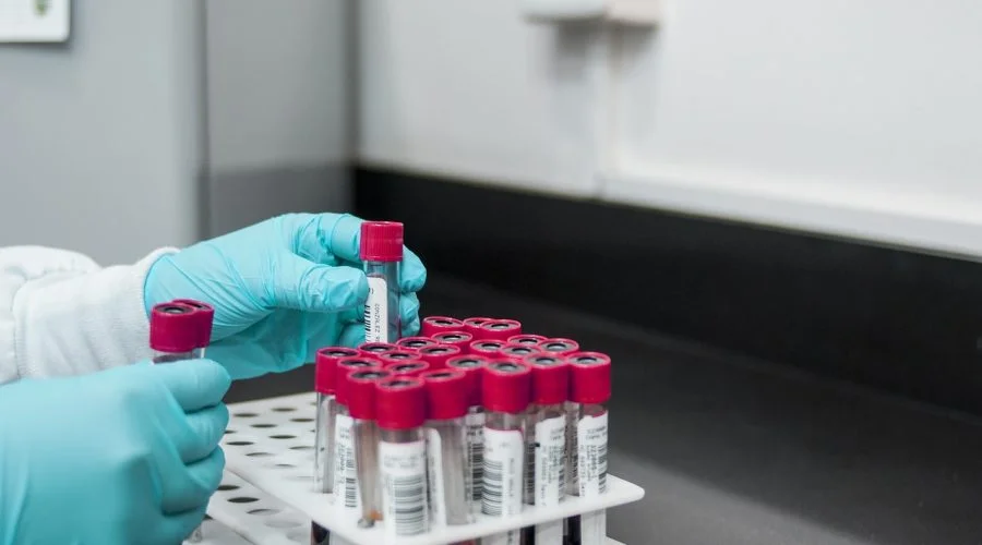 Are Scientists Finally Closing In On An HIV Cure? What a New UCSF Study Reveals