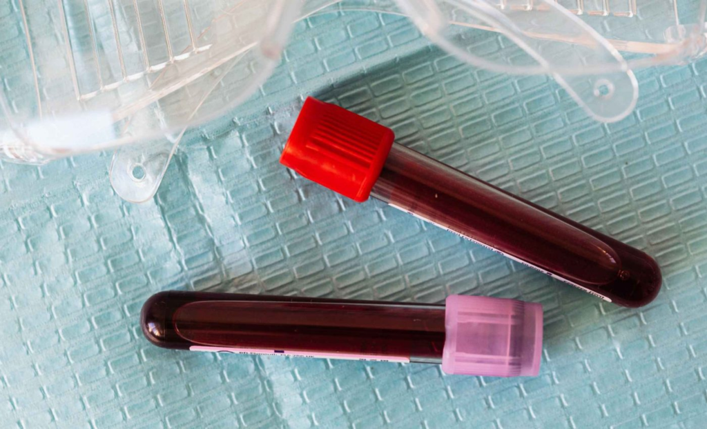 Brazilian Doctors Shocked to Discover ‘Male Blood’ in Woman Who Suffered Miscarriage