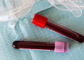 Brazilian Doctors Shocked to Discover ‘Male Blood’ in Woman Who Suffered Miscarriage