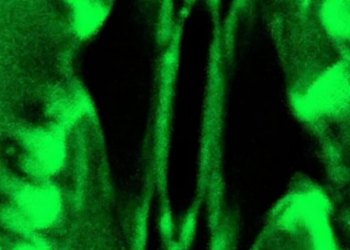 Plant “Breathing”