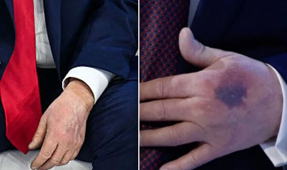 Hand