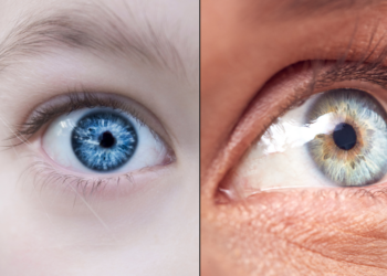 Do All Blue-Eyed People Share a Single Ancestor? The Science Behind The Viral Claim