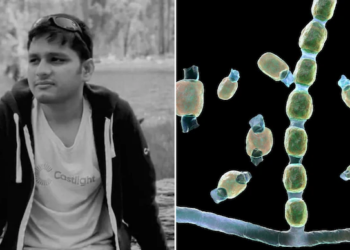 What Is Valley Fever? Death of Indian Tech Professional in California Highlights Risks of the Fungal Disease