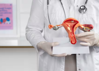 PCOS
