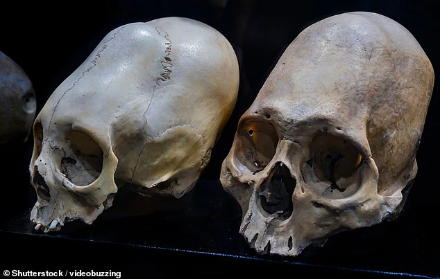 Peru Conehead Mummies Mystery Deepens as Latest DNA Test Fails to Identify Origins