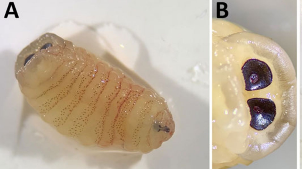 China: Woman's Growing Arm Lump Turns Out to Be Two Live Parasitic Worms, Doctors Say