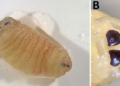 parasitic worms