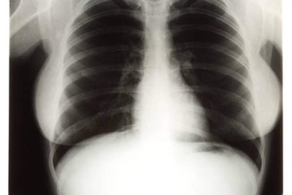 Marilyn Monroe’s Pelvic X-ray Auction Sparks Outrage as Critics Call Sale ‘Shameful’