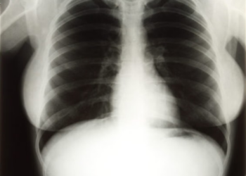 Marilyn Monroe’s Pelvic X-ray Auction Sparks Outrage as Critics Call Sale ‘Shameful’